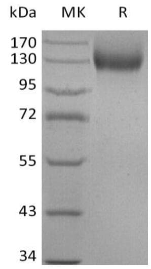 Human ACE2 / ACE-2 Protein (Recombinant mFc, C-terminus)