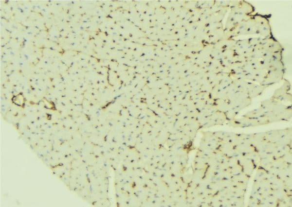 Polyclonal Rabbit anti-Human TTR / Transthyretin Antibody (IHC, WB)