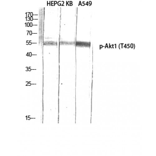 Polyclonal Rabbit anti-Human AKT1 Antibody (390-470 aa, IHC, WB)