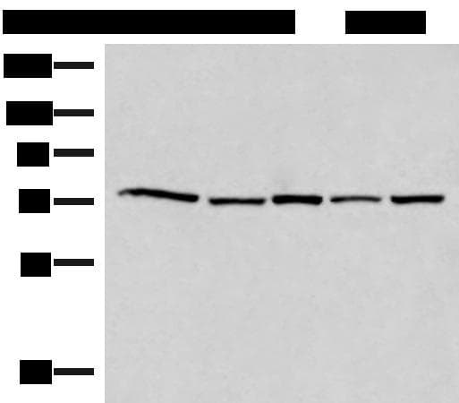 ATMIN Antibody