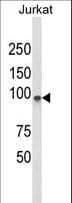 PLCL1 Antibody (aa149-176)