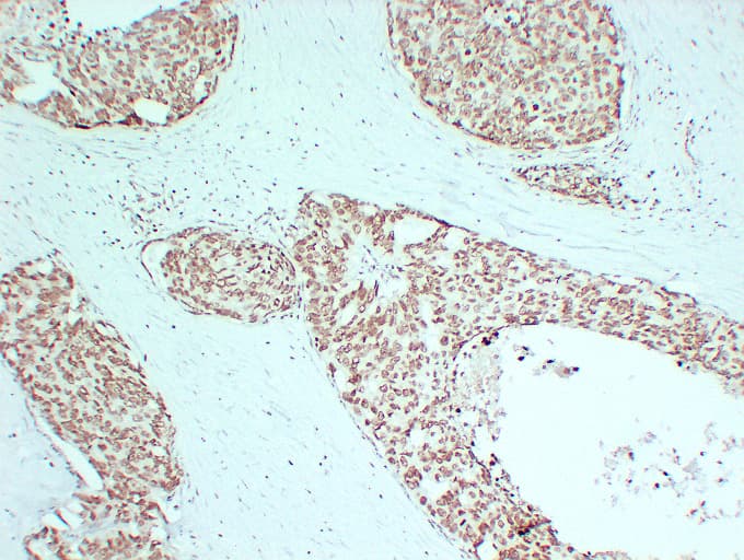 AR / Androgen Receptor Antibody (clone ABT-AR)