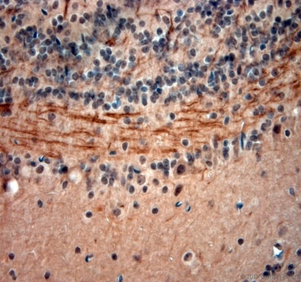 NEFH / NF-H Antibody (aa150-200)