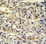 Polyclonal Rabbit anti-Human C1orf186 Antibody (aa121-150, IHC, WB)