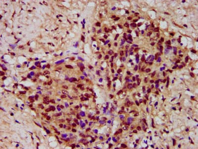 PYGO2 / Pygopus 2 Antibody