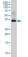 IHC-plus™ GYG1 / Glycogenin Antibody (clone 3B5)