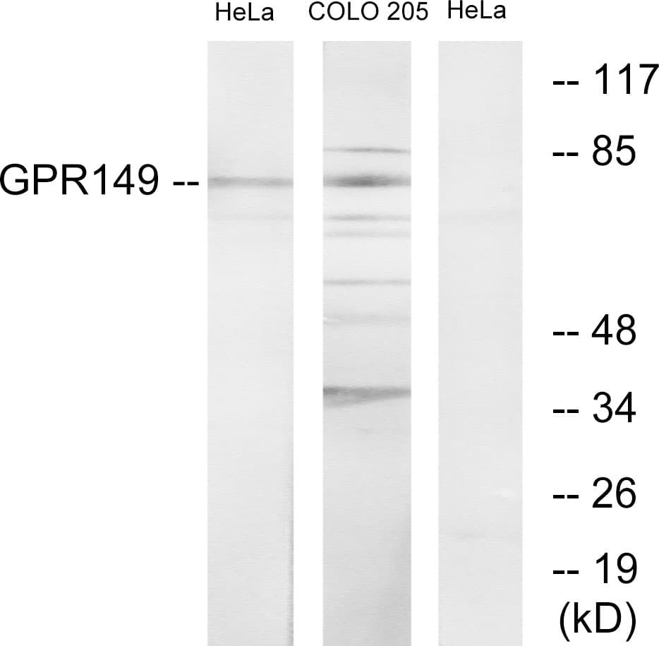 GPR149 / PGR10 Antibody (aa451-500)