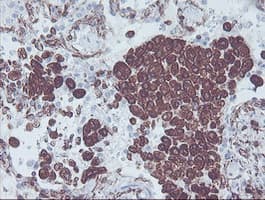 KIF2C / MCAK Antibody (clone OTI1C5)