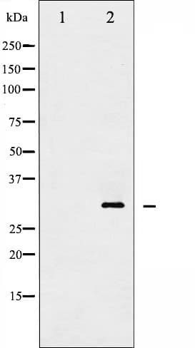 Polyclonal Rabbit anti-Human YWHAZ / 14-3-3 Zeta Antibody (phospho-Thr232, IHC, IF, WB)