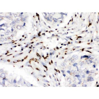 MDM4 / MDMX Antibody (aa35-72)