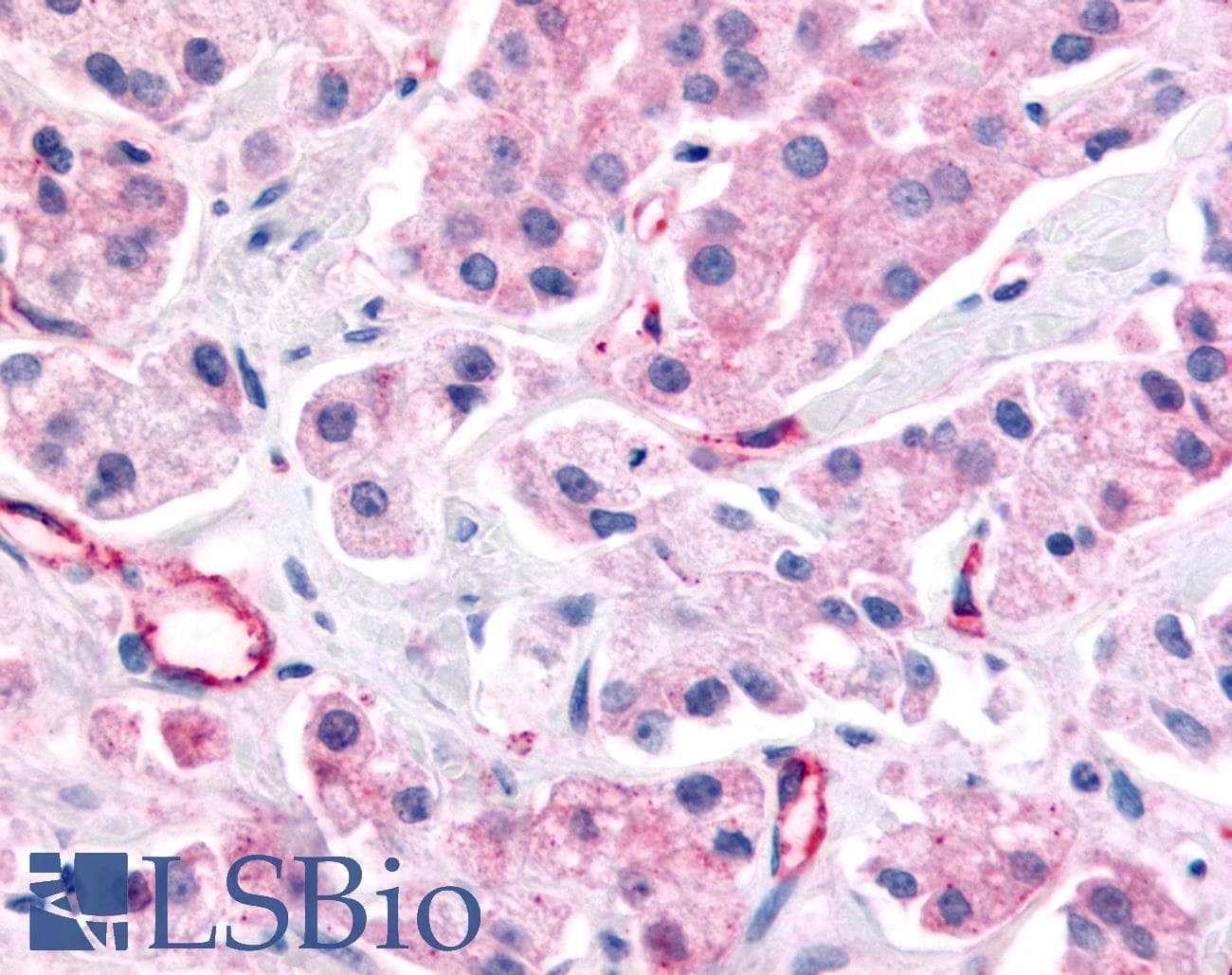 PathPlus™ Nor-1 / NR4A3 Antibody (Internal)