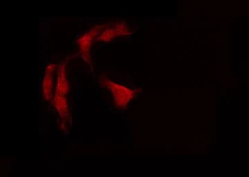 PRKCSH Antibody