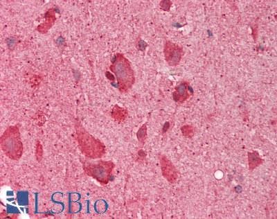 SLC17A5 Antibody (aa151-200)
