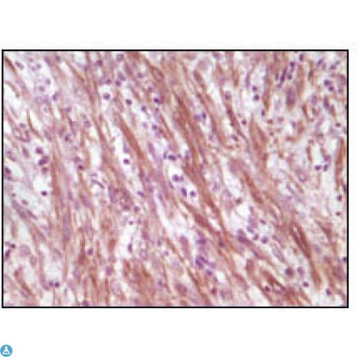 DES / Desmin Antibody