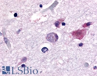 PathPlus™ Polyclonal Rabbit anti-Human CDC7 Antibody (Kinase Domain, IHC)