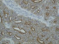 Monoclonal Mouse anti-Human Pan Cytokeratin Antibody (clone C-11, Biotin, IHC, WB)