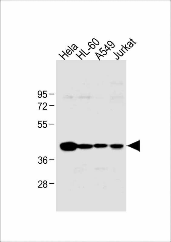 HLA-B Antibody (N-Terminus)