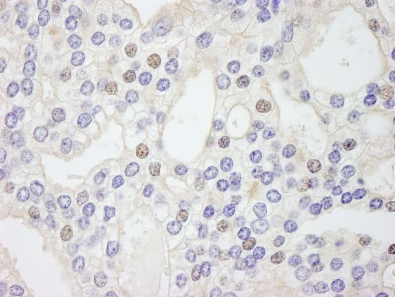 GTF3 / GTF2IRD1 Antibody (aa650-700)