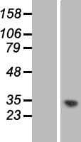 C1orf35 / MMTAG2 Protein (Over-Expression Lysate Myc-DDK (Flag))