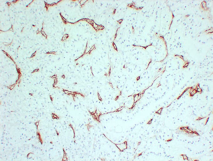 Monoclonal Mouse anti-Human CD105 Antibody (clone ABT-CD105, IHC)