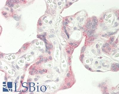 Polyclonal Rabbit anti-Mouse LINGO2 Antibody (C-Terminus, IHC, WB)