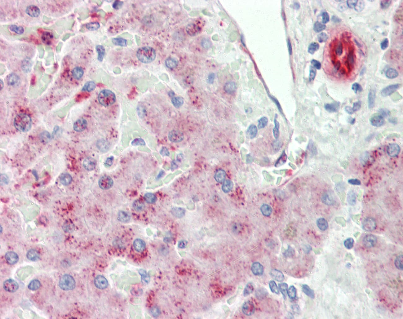 IGFALS / ALS Antibody (aa287-336)