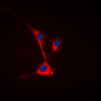 IHC-plus™ Polyclonal Rabbit anti-Human TUSC3 Antibody (Internal, IHC, IF, WB)