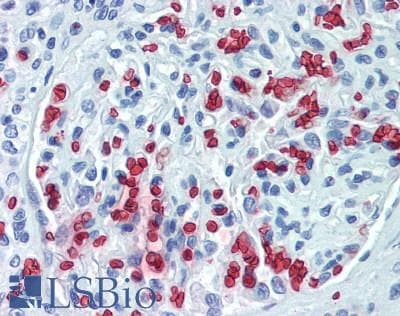 IHC-plus™ Polyclonal Rabbit anti-Human HBB / Hemoglobin Beta Antibody (IHC, WB)