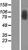 TRMT1L Protein (Over-Expression Lysate Myc-DDK (Flag))