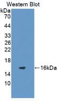IL8 / Interleukin 8 Antibody (clone A9)