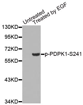 PDPK1 / PDK1 Antibody (phospho-Ser241)