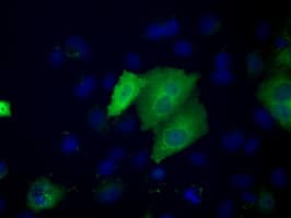 ACAT2 Antibody (clone OTI3E2)