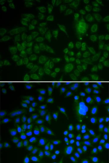 Polyclonal Rabbit anti-Human LRP1 / CD91 Antibody (aa20-270, IHC, IF, WB)