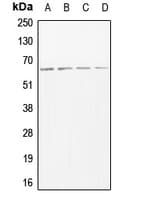 ADAM17 / TACE Antibody (Internal)