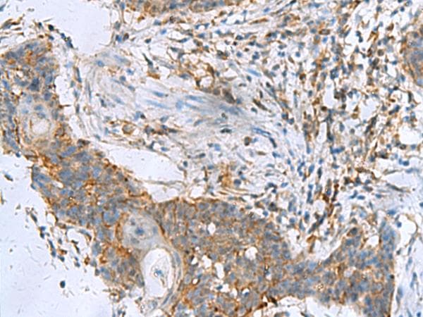 RPL10A Antibody