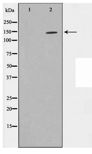 Polyclonal Rabbit anti-Human ZMYND8 / RACK7 Antibody (WB)