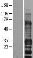 EDARADD Protein (Over-Expression Lysate Myc-DDK (Flag))