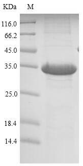 Mouse Reg1 Protein (Recombinant 6His-SUMO, N-terminus)