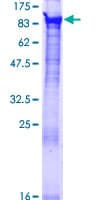 Human BBS7 Protein (Recombinant GST)