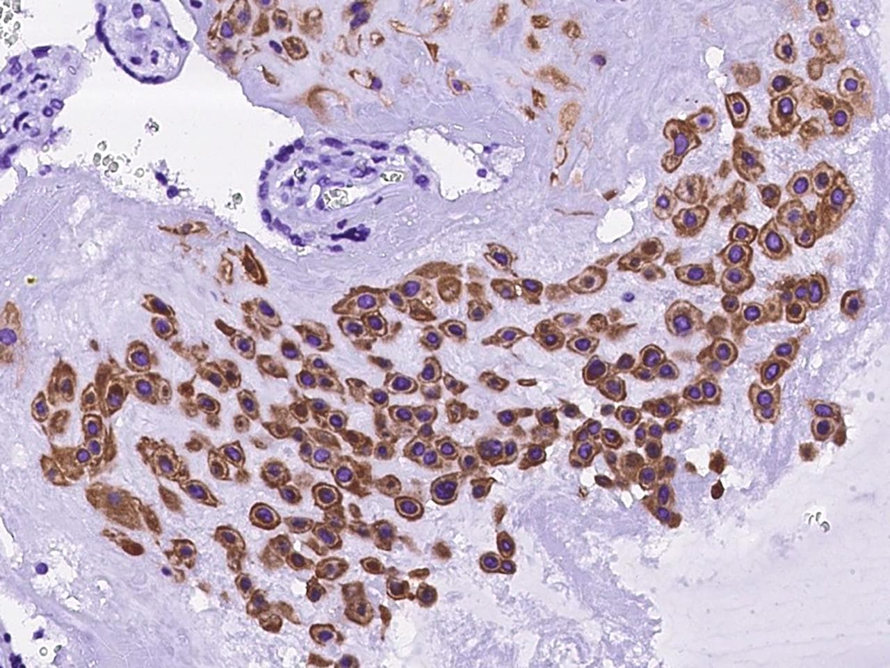 Polyclonal Rabbit anti-Human PGES / PTGES Antibody (IHC)