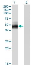 Monoclonal Mouse anti-Human SLC2A4 / GLUT-4 Antibody (clone 1F12, WB)