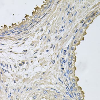Polyclonal Rabbit anti-Human HERC3 Antibody (IHC, WB)