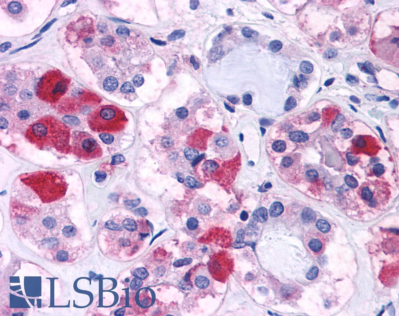 PathPlus™ CRFR1 / CRHR1 Antibody (N-Terminus)