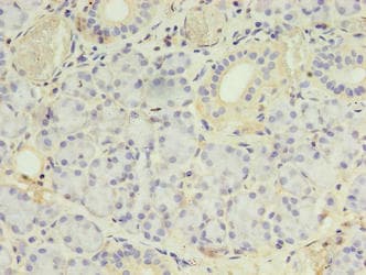 PLCD4 Antibody (aa1-762)