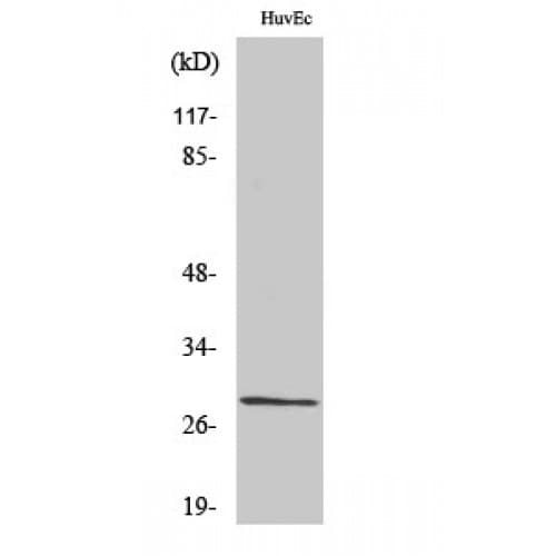 CSNK2B / Phosvitin Antibody (140-220 aa)