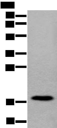 Polyclonal Rabbit anti-Human MRLC2 / MYL12B Antibody (IHC, WB)