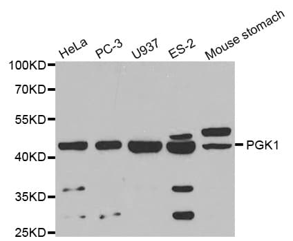 PGK1 / Phosphoglycerate Kinase Antibody