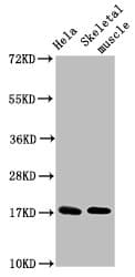 UBE2D3 / UBCH5C Antibody (aa1-147)