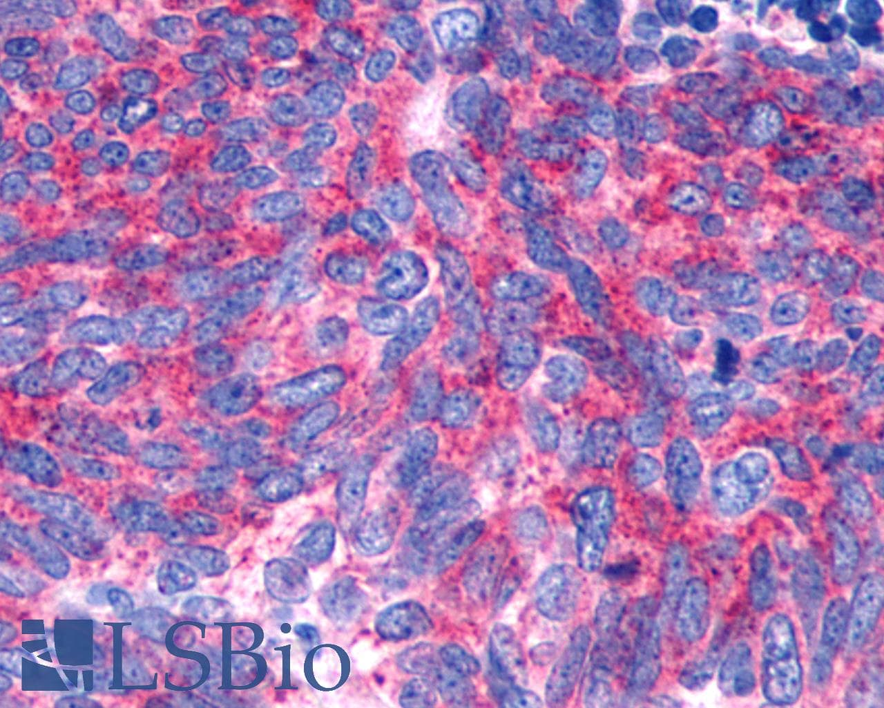 PathPlus™ Polyclonal Rabbit anti-Human GPR146 Antibody (C-Terminus, IHC)