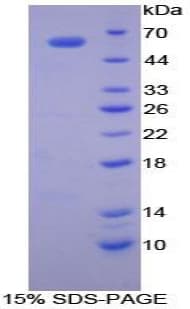 Dog CTSK / Cathepsin K Protein (Recombinant His-GST)